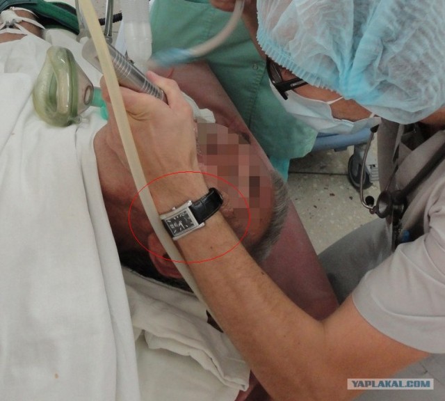 36 часов из жизни анестезиолога