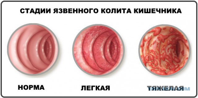 Застряли в 20 веке или почему мрут люди.