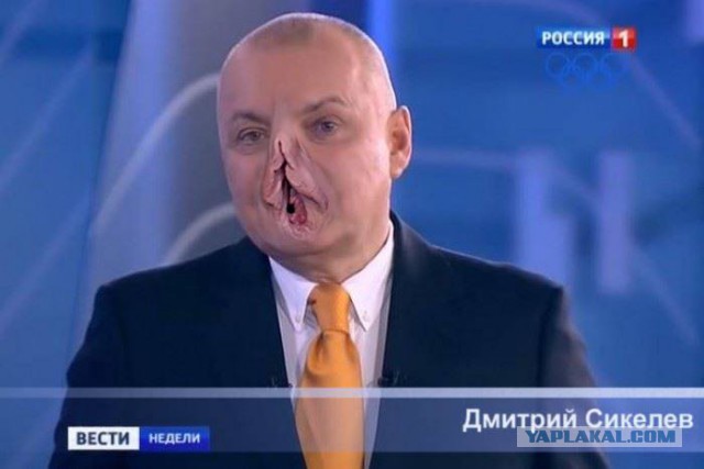 Телеведущий Дмитрий Киселев объяснил разбитое в Крыму лицо сменой имиджа, которая «отражает его позицию