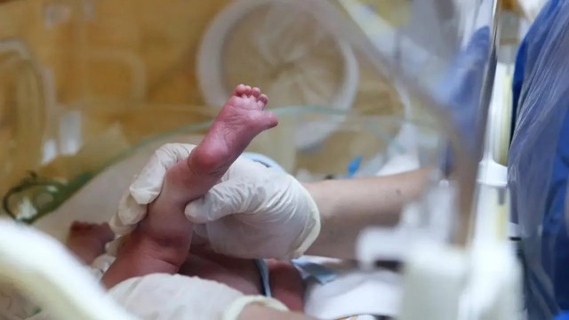 Младенца весом всего 367 граммов спасли в Подмосковье.