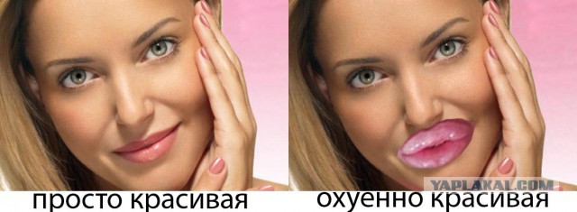 Девушка переборщила с ботексом и силиконом