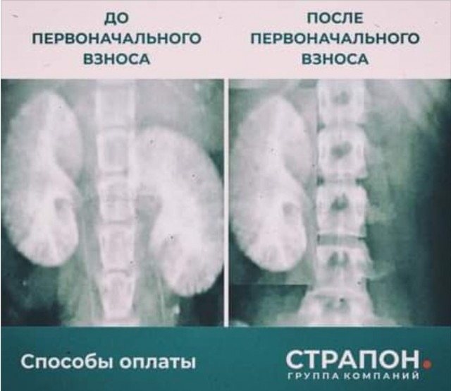 ЖК Ненастье
