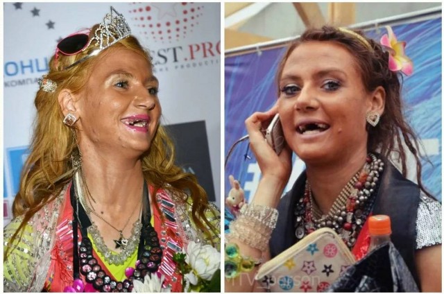 Снимать ли зубы перед первым знакомством