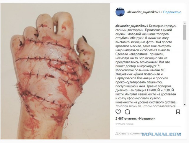 25-летний молодой человек подверг часовой пытке свою жену