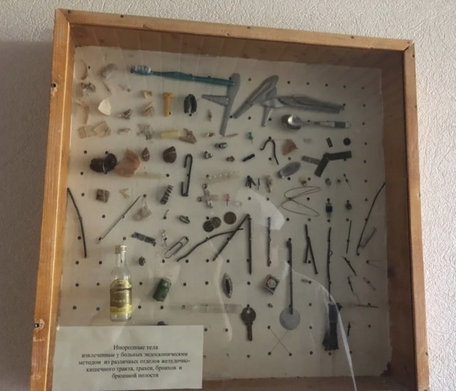 Рай коллекционера: самарские медики показали, какие предметы вытаскивают из пациентов