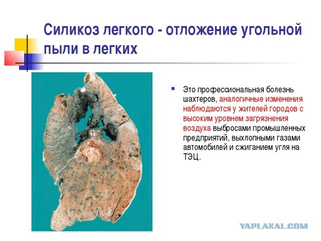 Cамое интересное о работе патологоанатома. Истории из жизни.