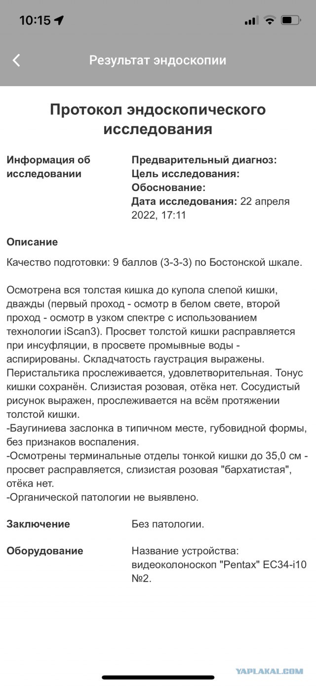 Колоноскопия