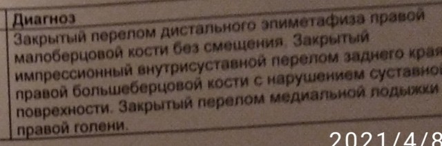 Приобрел инвалидную коляску, делюсь опытом эксплуатации