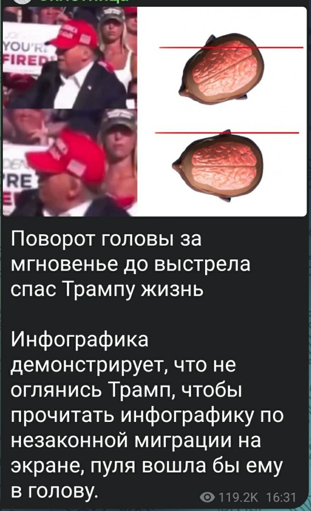 Трамп рассказал, что за чудо спасло его жизнь: в момент выстрела политик повернул голову, чтобы прочитать надписи на плакатах о нелегальных мигрантах