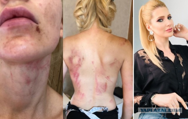 Спортсменку, нанесшую телесные повреждения двум кавказцам, взяли под стражу