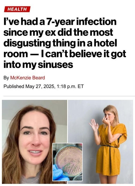 Девушка уже 7 лет страдает от инфекций носовых пазух, потому что бывший пёрнул ей в лицо