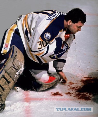 12 примеров травмопасности спорта