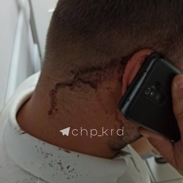 В Краснодаре депутат-коммерсант припугнул конкурентов, заказав нападение на их сотрудника!