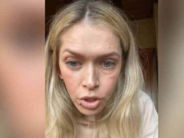 Меладзе и Брежнева распродают права на русскоязычные песни