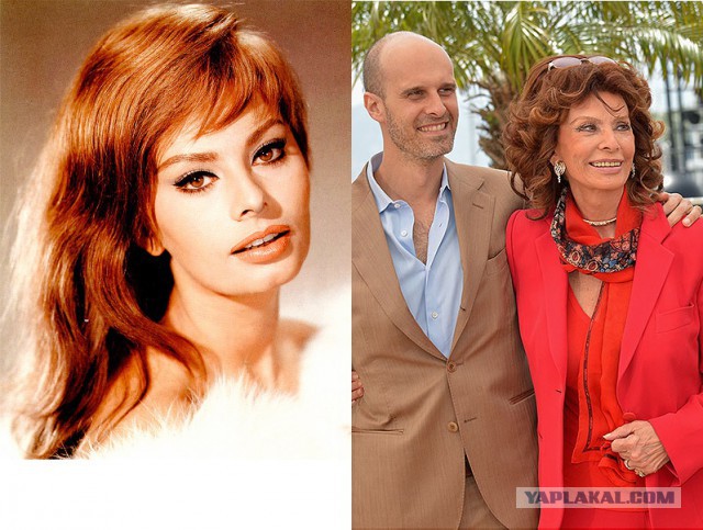 Знаменитости, которые безобразно стареют