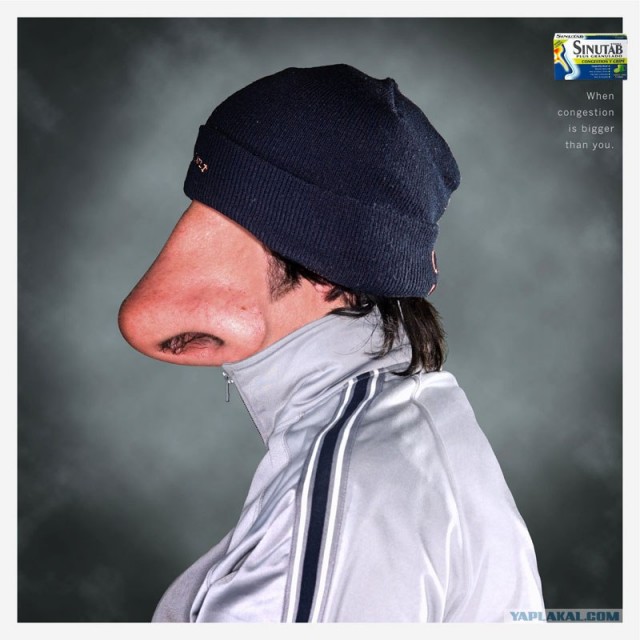 Насморк у Гиви