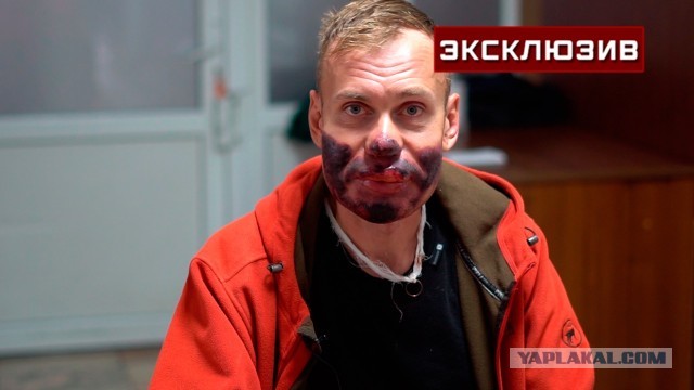 Мой Эльбрус или горы ошибок не прощают