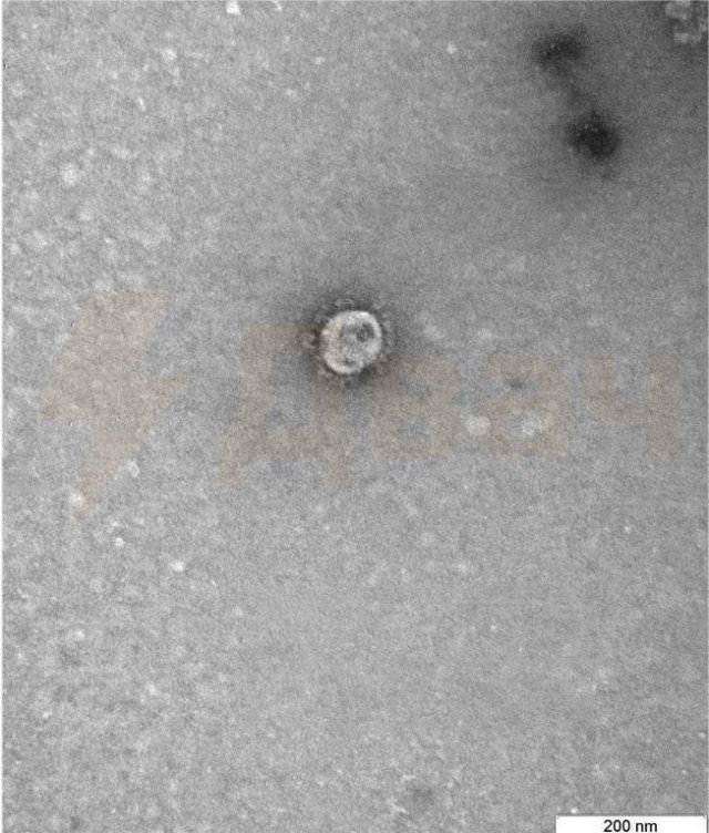 В Новосибе показали первые изображения коронавируса COVID-19 под микроскопом