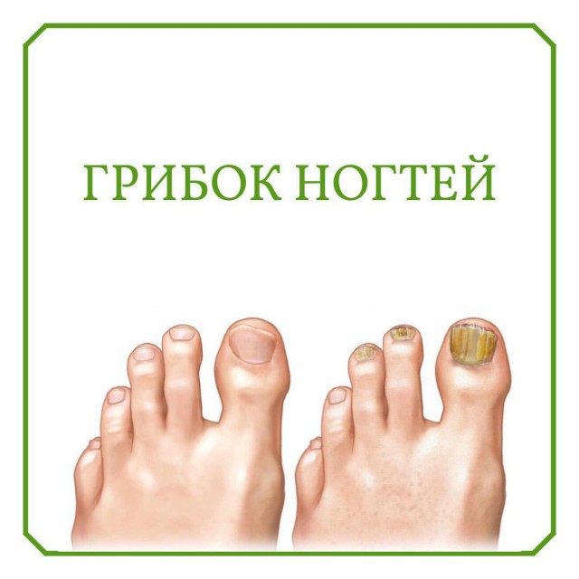 Почему инопланетяне до сих пор не установили контакт с человечеством?