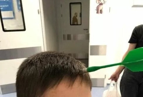 Мальчика с дротиком, торчащим из черепа, спасли врачи Подмосковья