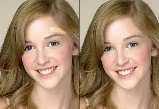 Пластырь-хамелеон