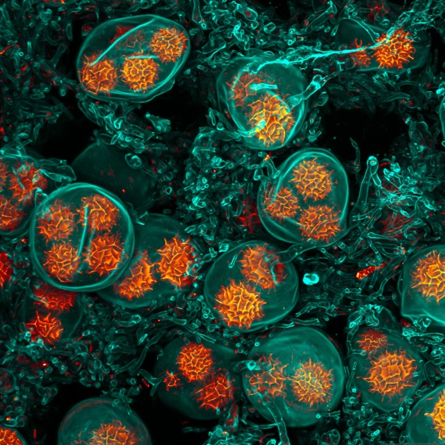 Жизнь под микроскопом: 11 победителей фотоконкурса Nikon Small World 2024