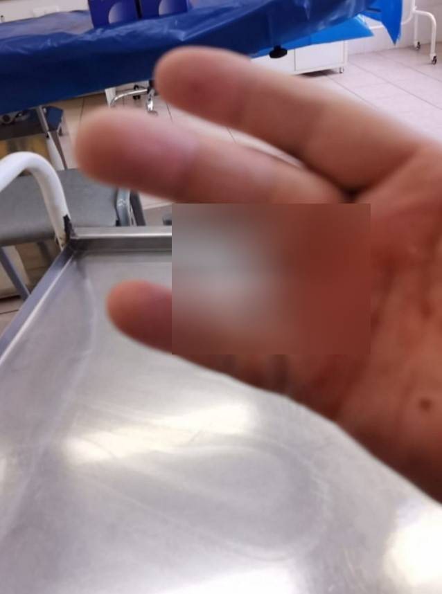 Петербуржцу оторвало палец на детской площадке, когда он катал дочь на качелях