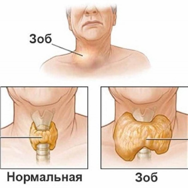 Чем поразили ученых зубы Ивана Грозного