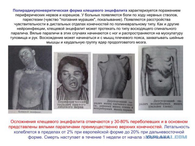 Поймал на рыбалке