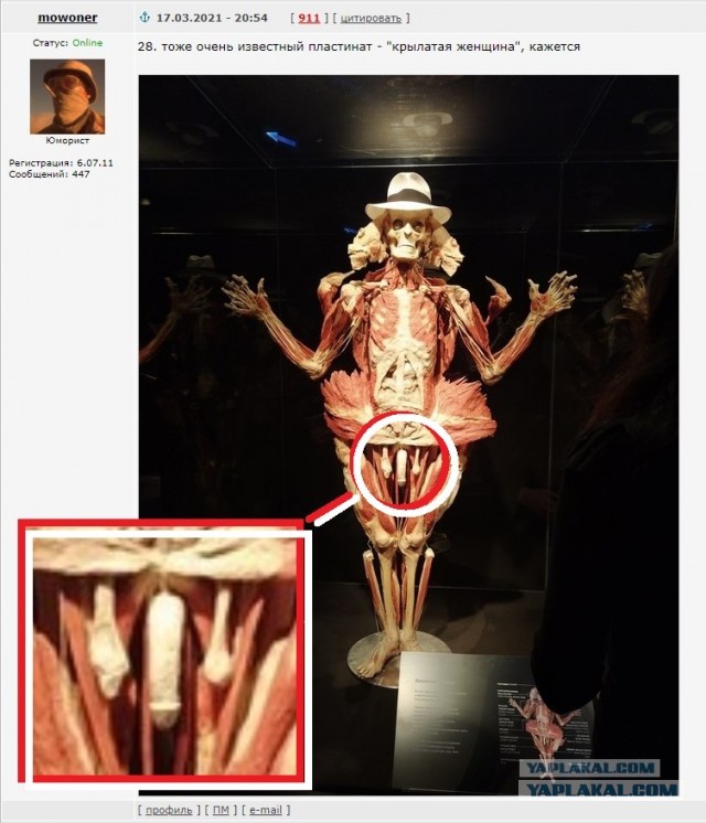 Посетил выставку Body Worlds на ВДНХ