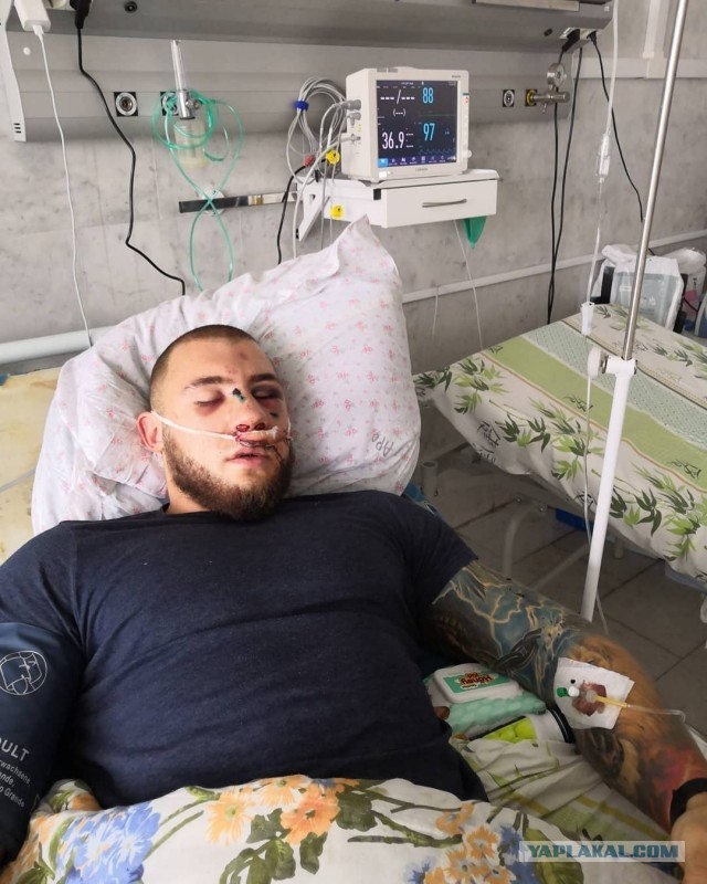 Опять Шамиль,снова драка или реанимация за сделанное замечание.