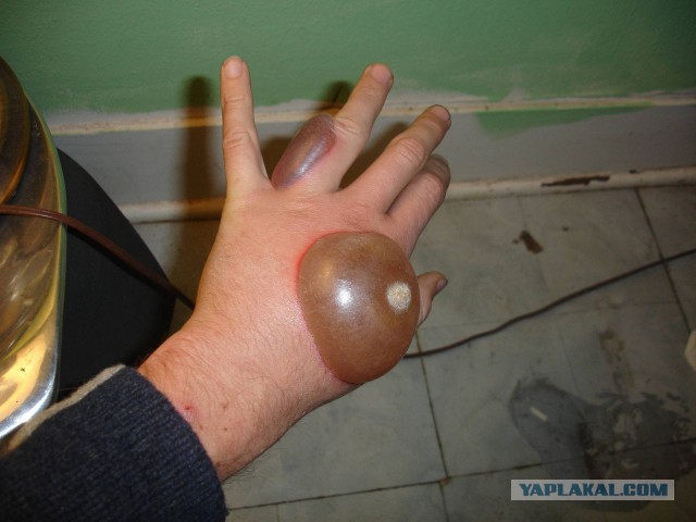 Чудесное исцеление дырявой ежихи