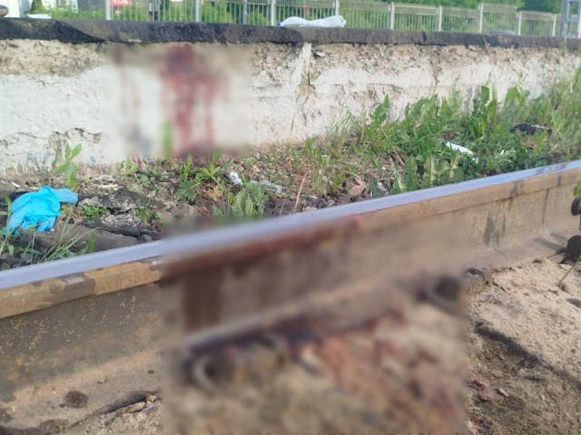 В Подмосковье альтернативно одаренному 11 летнему зацеперу поезд внезапно отрезал ногу.