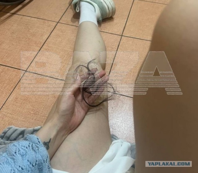 Россиянка полтора года выхаживала своего парня после страшной аварии, а когда он поправился — избил её, бросил и уехал с деньгами