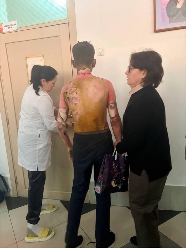 В Красноярске восьмиклассница облила бензином и подожгла одноклассника