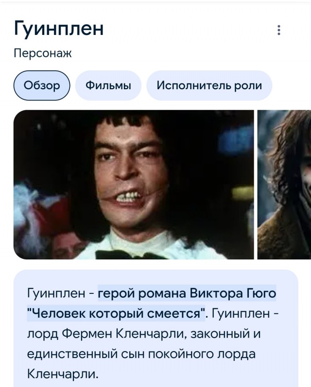 Молодой москвич порвал себе рот шаурмой. Парень был очень голоден и сильно торопился