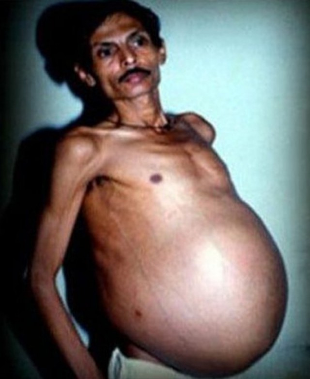 Самые неожиданные вещи, найденные в теле человека