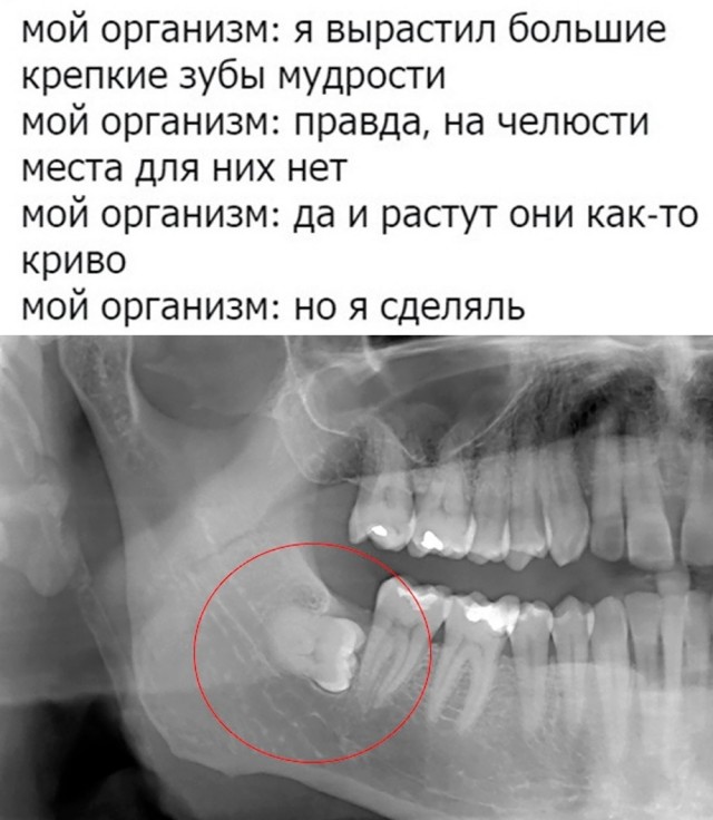Весёлый полтишок 1.03