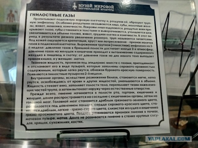 Что происходит с телом после смерти