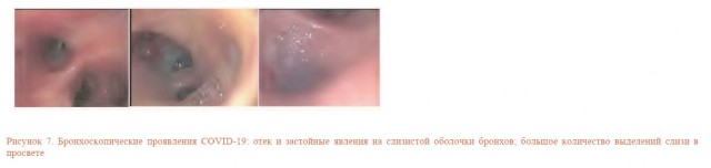 Здравоохранение у нас супер!