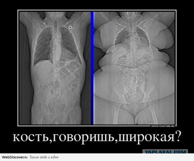 Ей хотелось хорошо выглядеть на свадьбе