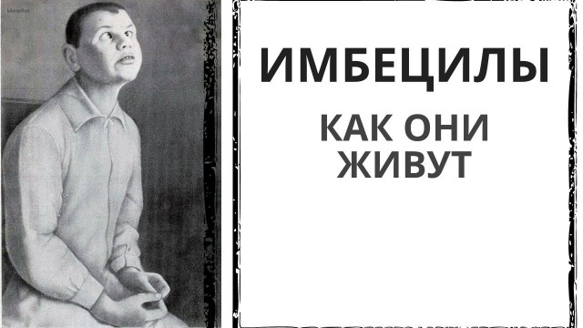 Имбецильность