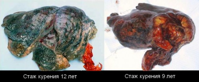 Три месяца не курю
