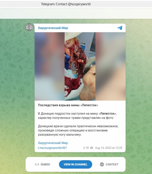 Самодельное взрывное устройство сдетонировало под автомобилем в Москве.