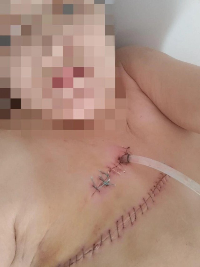 Вагнеровец чуть не убил ножом женщину в Чите и избежал суда