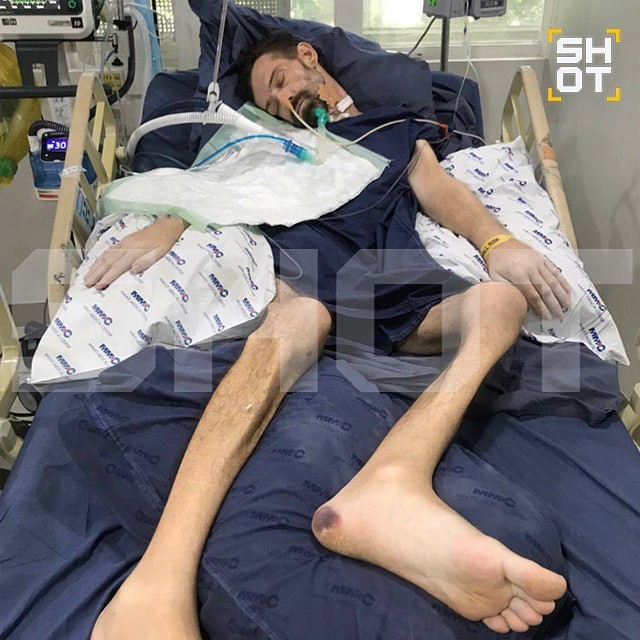 Подушка безопасности «хонды» пробила сонную артерию российскому туристу на Филиппинах и сделала его инвалидом