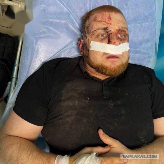 В Краснодаре закладчики напали на полицейских, которые пытались их задержать
