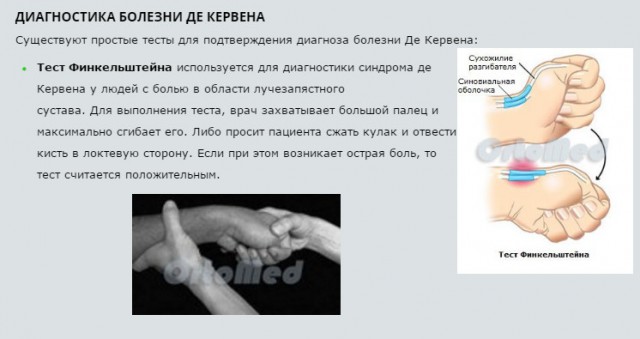 Когда идиотам делать нечего: люди делают себе вывих большого пальца и делятся результатами