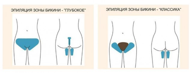 Надо ли мужику брить пах: плюсы и минусы
