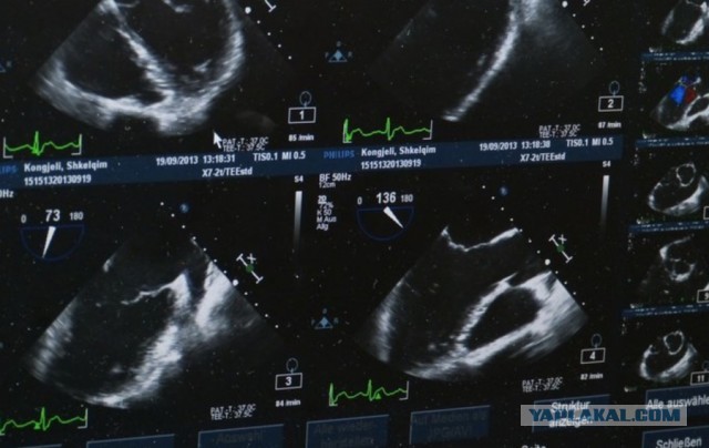 История УЗИ